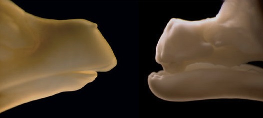 Chicken embryo showing tooth development